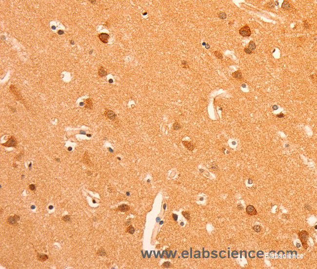 Immunohistochemistry of paraffin-embedded Human brain tissue using GRM3 Polyclonal Antibody at dilution 1:50