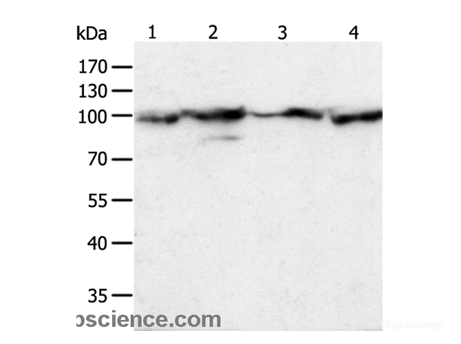 Western Blot analysis of Hela cell and Human liver cancer tissue, Jurkat and NIH/3T3 cell using HSP90B1 Polyclonal Antibody at dilution of 1:500