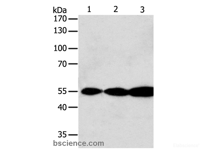 Western Blot analysis of Jurkat, Hela and A549 cell using GSR Polyclonal Antibody at dilution of 1:750