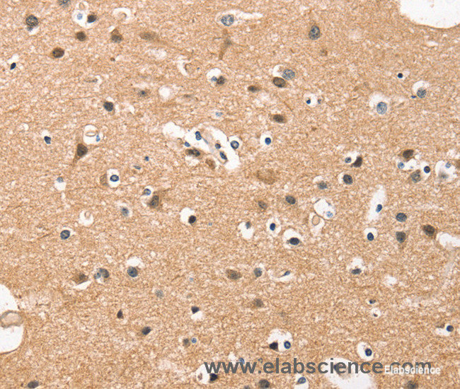 Immunohistochemistry of paraffin-embedded Human brain tissue using HDAC8 Polyclonal Antibody at dilution 1:50