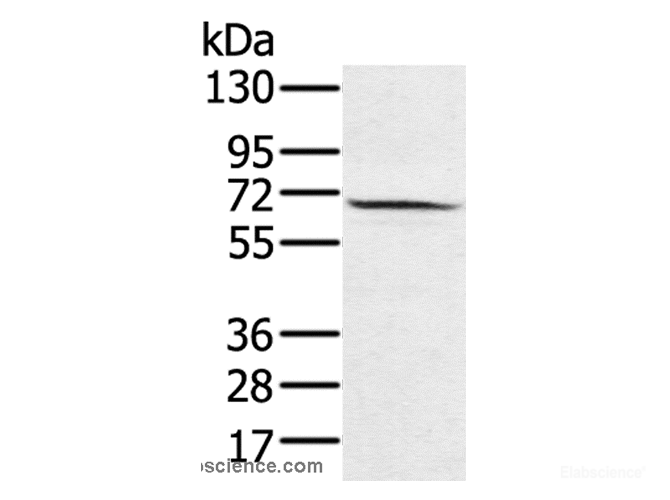 Western Blot analysis of Hela cell using HSF2 Polyclonal Antibody at dilution of 1:550