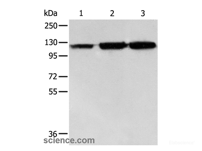 Western Blot analysis of PC3 cell, Human colon cancer and liver cancer tissue using HSP105 Polyclonal Antibody at dilution of 1:500