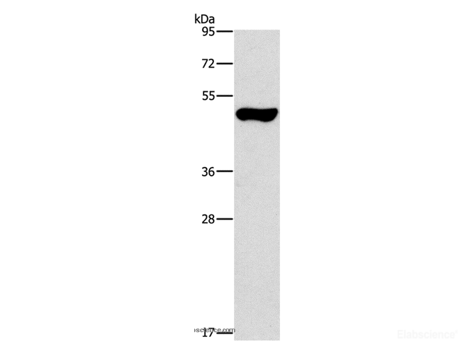 Western Blot analysis of Mouse pancreas tissue using ILK Polyclonal Antibody at dilution of 1:550
