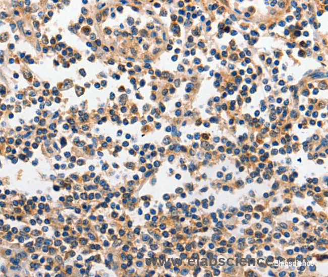 Immunohistochemistry of paraffin-embedded Human tonsil tissue using INHA Polyclonal Antibody at dilution 1:120