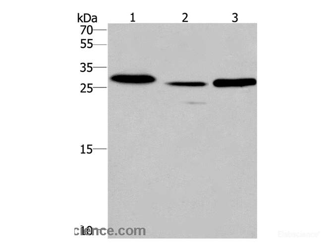 Western Blot analysis of Human fetal liver tissue and Mouse heart tissue,Human testis tissue using IRAK1BP1 Polyclonal Antibody at dilution of 1:475