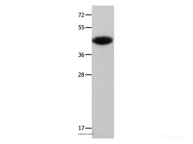 Western Blot analysis of Mouse muscle tissue using MAP2K6 Polyclonal Antibody at dilution of 1:500
