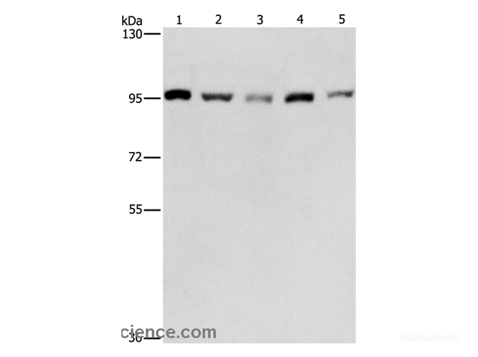 Western Blot analysis of HepG2, K562, Jurkat, 231 and hela cell using CDC46 Polyclonal Antibody at dilution of 1:475
