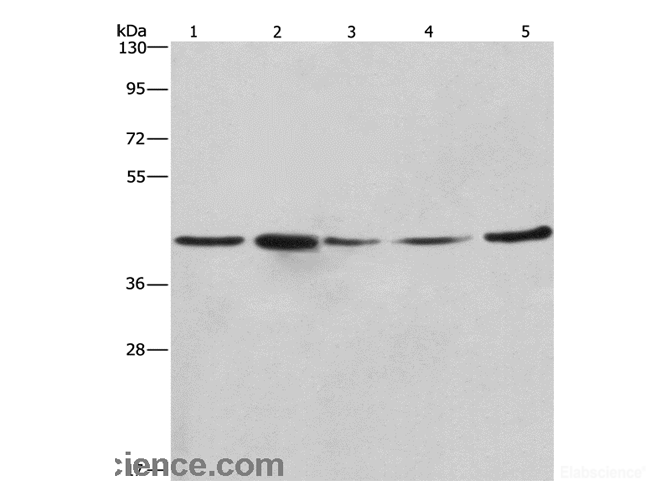 Western Blot analysis of A549, NIH/3T3 and 293T cell,Human hepatocellular carcinoma tissue and hela cell using RPSA Polyclonal Antibody at dilution of 1:425