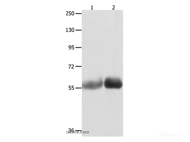 Western Blot analysis of Human liver cancer and stomach cancer tissue using MUTYH Polyclonal Antibody at dilution of 1:1000