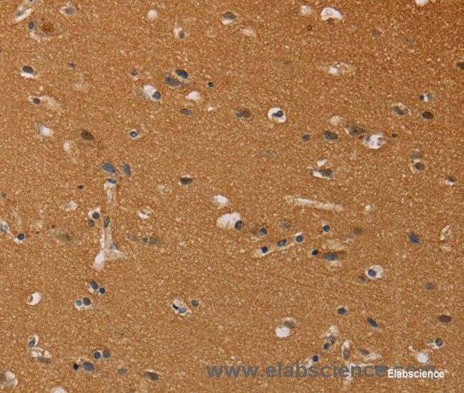 Immunohistochemistry of paraffin-embedded Human brain tissue using CHRNA4 Polyclonal Antibody at dilution 1:40