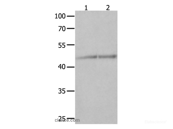 Western Blot analysis of Jurkat and K562 cell using NCK1 Polyclonal Antibody at dilution of 1:600