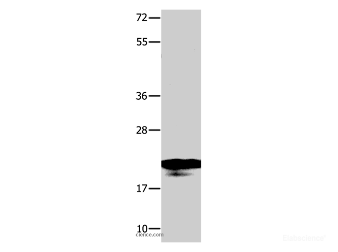 Western Blot analysis of A549 cell using NME1 Polyclonal Antibody at dilution of 1:950