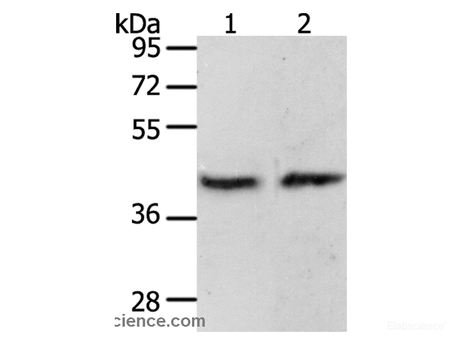 Western Blot analysis of MCF7 cell and Mouse brain tissue using PAX8 Polyclonal Antibody at dilution of 1:250
