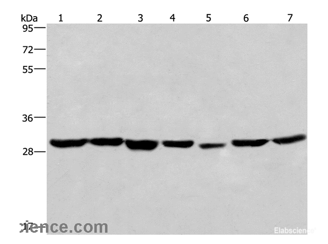 Western Blot analysis of 293T and A549 cell,Human liver cancer tissue and PC3 cell ,Human placenta tissue,hela cell and Mouse heart tissue using PHB Polyclonal Antibody at dilution of 1:350