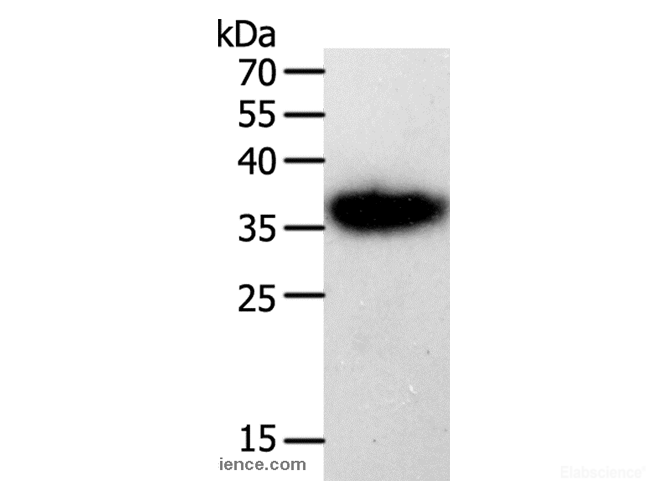 Western Blot analysis of A549 cell using PLAUR Polyclonal Antibody at dilution of 1:450