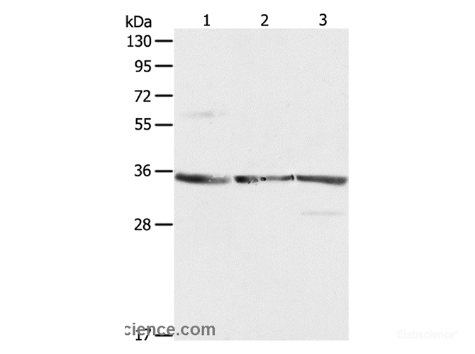 Western Blot analysis of NIH/3T3, A431 and Jurkat cell using RPLP0 Polyclonal Antibody at dilution of 1:750