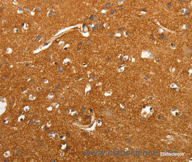 Immunohistochemistry of paraffin-embedded Human brain tissue using SLC4A4 Polyclonal Antibody at dilution 1:50