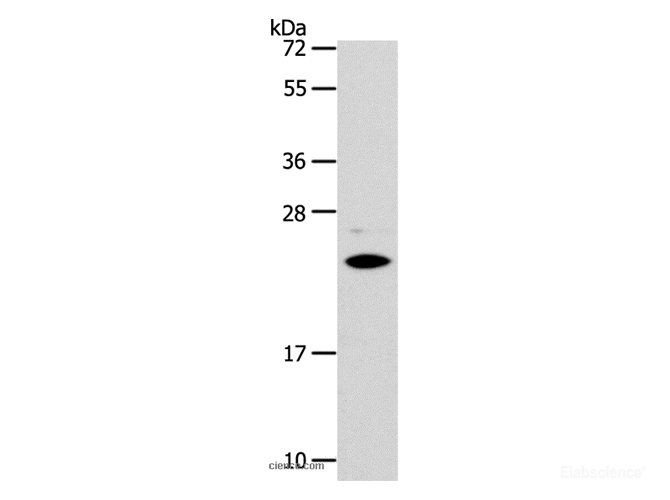 Western Blot analysis of Mouse liver tissue using SOD2 Polyclonal Antibody at dilution of 1:950