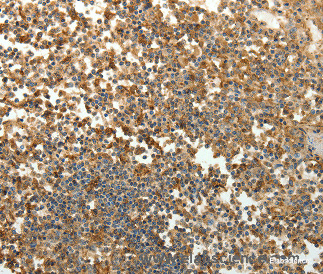 Immunohistochemistry of paraffin-embedded Human tonsil tissue using SFTPD Polyclonal Antibody at dilution 1:30
