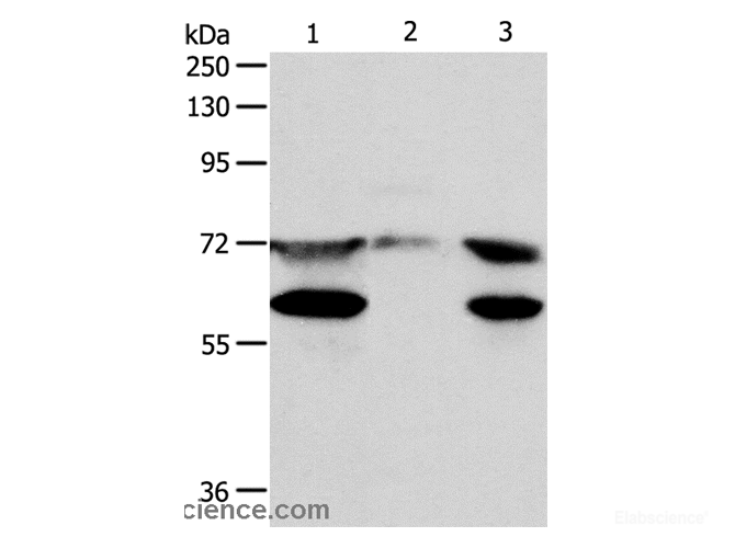 Western Blot analysis of Hela cell, Mouse testis tissue and Jurkat cell using CCDC99 Polyclonal Antibody at dilution of 1:400