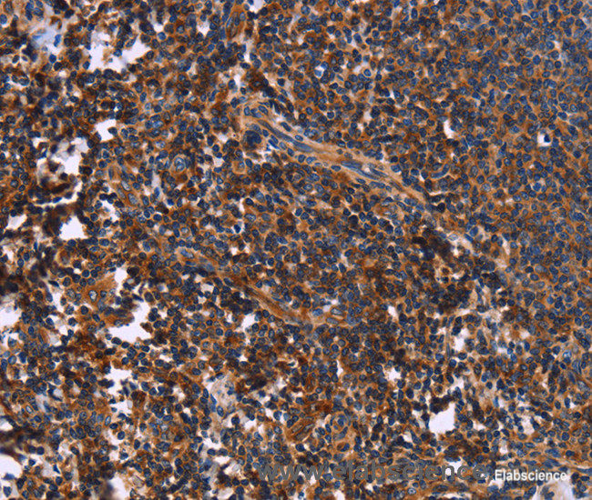 Immunohistochemistry of paraffin-embedded Human tonsil tissue using SYT4 Polyclonal Antibody at dilution 1:60