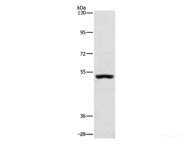 Western Blot analysis of Mouse kidney tissue using SYT17 Polyclonal Antibody at dilution of 1:650