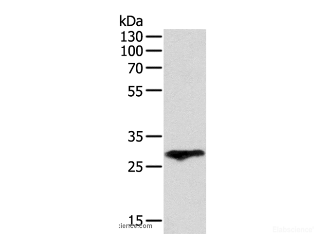 Western Blot analysis of Human fetal lung tissue using F3 Polyclonal Antibody at dilution of 1:400