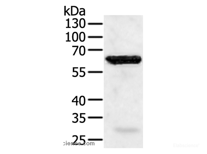 Western Blot analysis of Jurkat cell using TRAF5 Polyclonal Antibody at dilution of 1:450