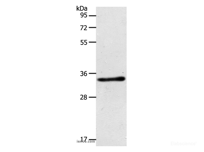 Western Blot analysis of Mouse kidney tissue using ACY3 Polyclonal Antibody at dilution of 1:500