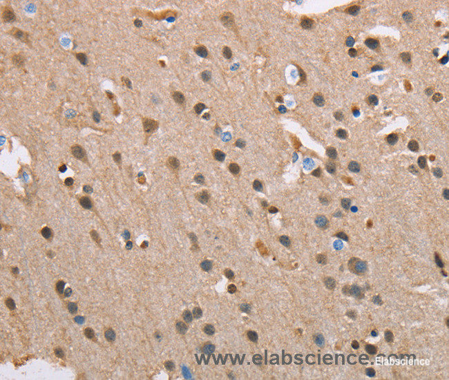 Immunohistochemistry of paraffin-embedded Human brain tissue using SERPINA1 Polyclonal Antibody at dilution 1:45