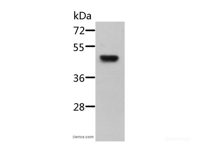 Western Blot analysis of Mouse pancreas tissue using STRADB Polyclonal Antibody at dilution of 1:500