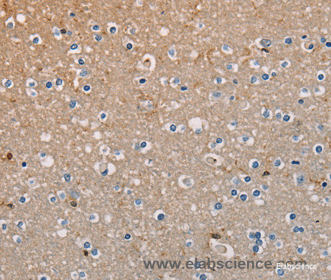 Immunohistochemistry of paraffin-embedded Human brain tissue using AMBRA1 Polyclonal Antibody at dilution 1:50
