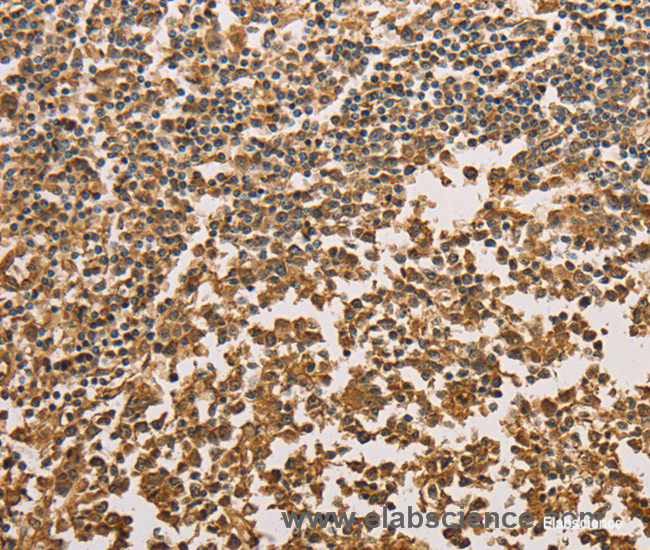 Immunohistochemistry of paraffin-embedded Human tonsil tissue using SETD2 Polyclonal Antibody at dilution 1:40
