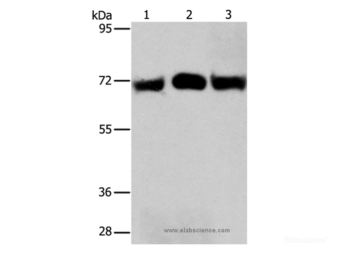 Western Blot analysis of Hela and A549 cell, Human liver cancer tissue using RPN1 Polyclonal Antibody at dilution of 1:350