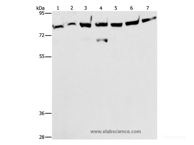 Western Blot analysis of A172 cell and Mouse brain tissue, K562, 231, A549, hela and hepG2 cell using PKC epsilon Polyclonal Antibody at dilution of 1:400