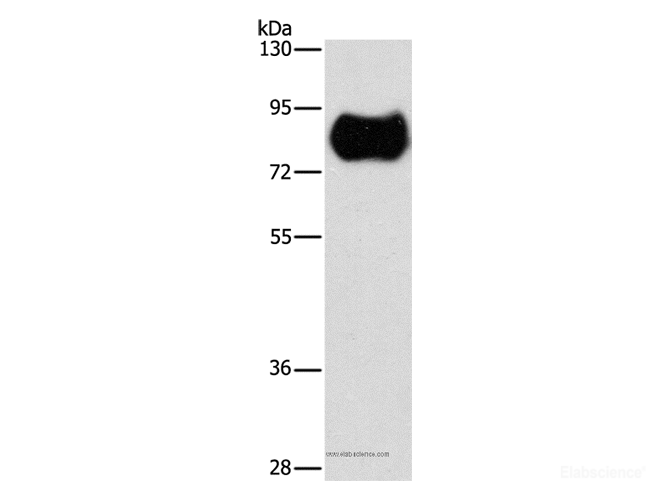Western Blot analysis of Human fetal brain tissue using MAP4K2 Polyclonal Antibody at dilution of 1:900