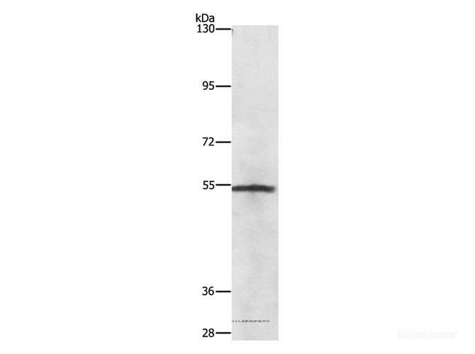 Western Blot analysis of Lovo cell using NEK2 Polyclonal Antibody at dilution of 1:727