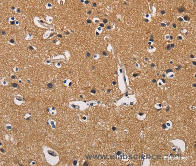 Immunohistochemistry of paraffin-embedded Human brain tissue using CBY1 Polyclonal Antibody at dilution 1:60