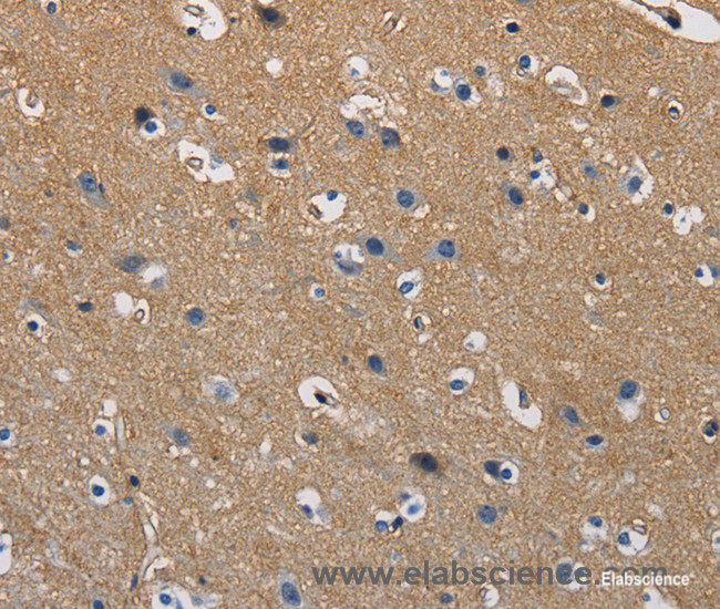 Immunohistochemistry of paraffin-embedded Human brain tissue using GSTA2 Polyclonal Antibody at dilution 1:50