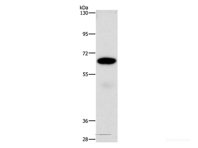 Western Blot analysis of A549 cell using CD73 Polyclonal Antibody at dilution of 1:850