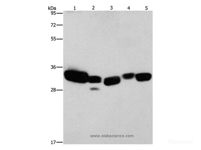 Western Blot analysis of Mouse liver and Human fetal lung tissue, hela cell and Mouse kidney tissue, Human brain malignant glioma tissue using CBR1 Polyclonal Antibody at dilution of 1:900
