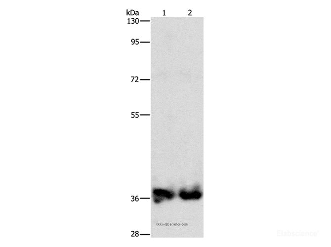 Western Blot analysis of Mouse kidney and Human fetal kidney tissue using ASPA Polyclonal Antibody at dilution of 1:1400
