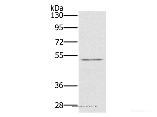 Western Blot analysis of HT-29 cell using HTR3C Polyclonal Antibody at dilution of 1:500
