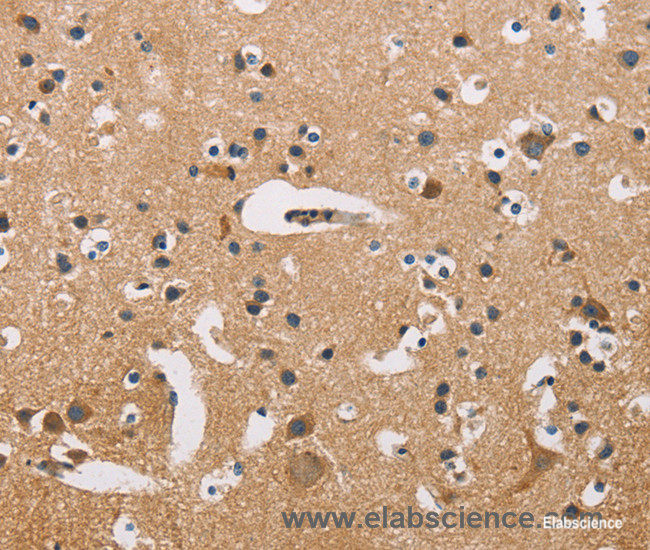 Immunohistochemistry of paraffin-embedded Human brain tissue using ATP2C1 Polyclonal Antibody at dilution 1:50