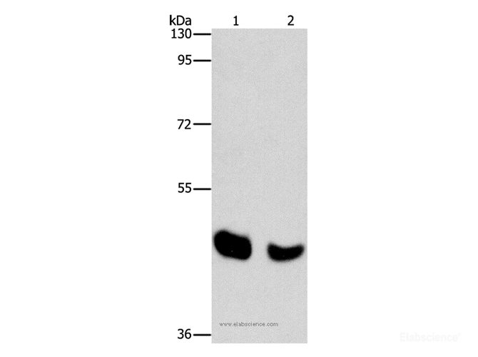 Western Blot analysis of Human normal liver and Mouse pancreas tissue using BAAT Polyclonal Antibody at dilution of 1:650