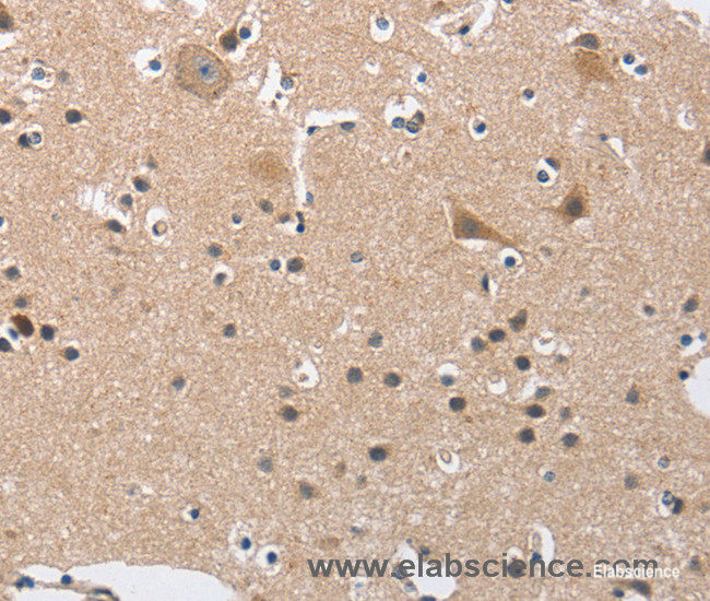 Immunohistochemistry of paraffin-embedded Human brain tissue using BUB1 Polyclonal Antibody at dilution 1:50