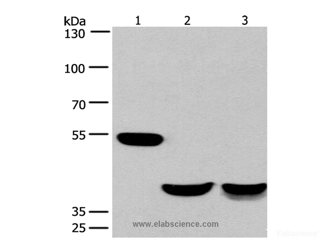 Western Blot analysis of Mouse brain and Human fetal muscle tissue, Mouse heart tissue using CABLES1 Polyclonal Antibody at dilution of 1:650