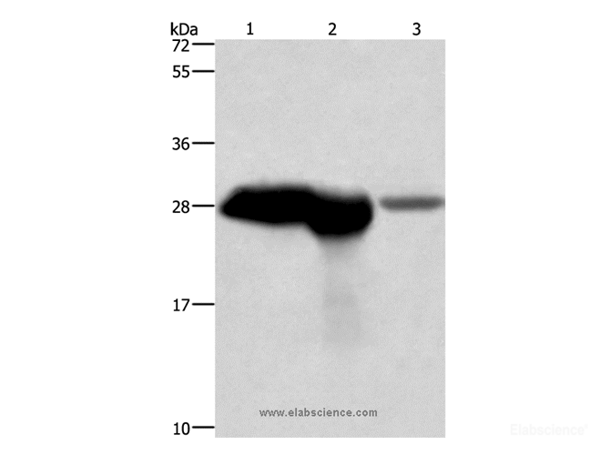 Western Blot analysis of Mouse brain and kidney tissue, Human fetal brain tissue using CALB1 Polyclonal Antibody at dilution of 1:750