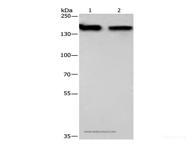 Western Blot analysis of 293T and hela cell using NCAPD2 Polyclonal Antibody at dilution of 1:425