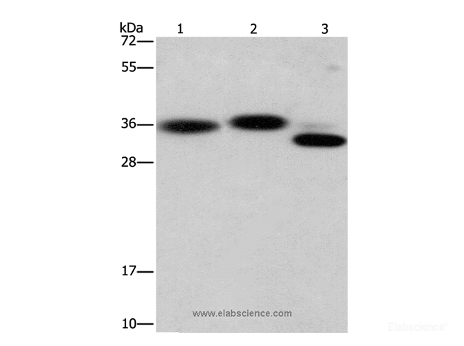 Western Blot analysis of Hela cell, Mouse brain and heart tissue using CAPZA2 Polyclonal Antibody at dilution of 1:650